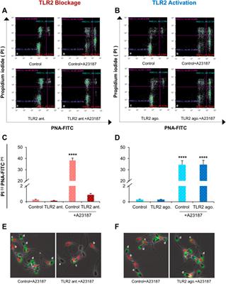 Toll-like Receptor 2 is Involved in Calcium Influx and Acrosome Reaction to Facilitate Sperm Penetration to Oocytes During in vitro Fertilization in Cattle